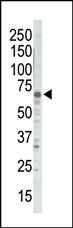 GRK5 Antibody