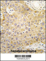 GRK5 Antibody