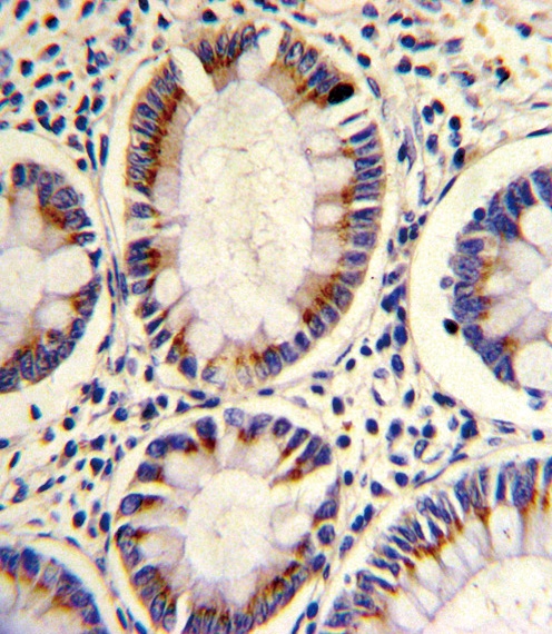 ARGBP2 Antibody