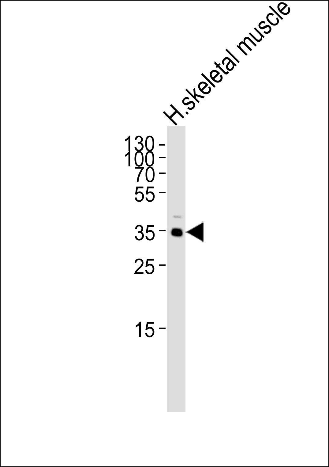 IFNGR2 Antibody