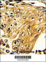 IFNGR2 Antibody