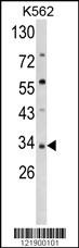 SFRP5 Antibody