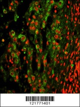 ITGAX Antibody