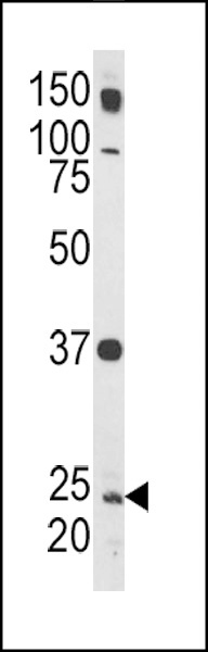 RAB5A Antibody