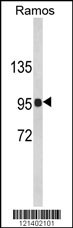 CR2 Antibody