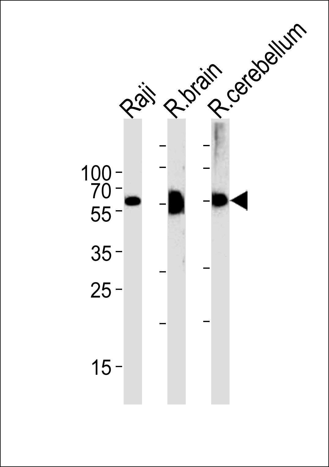 CBS Antibody