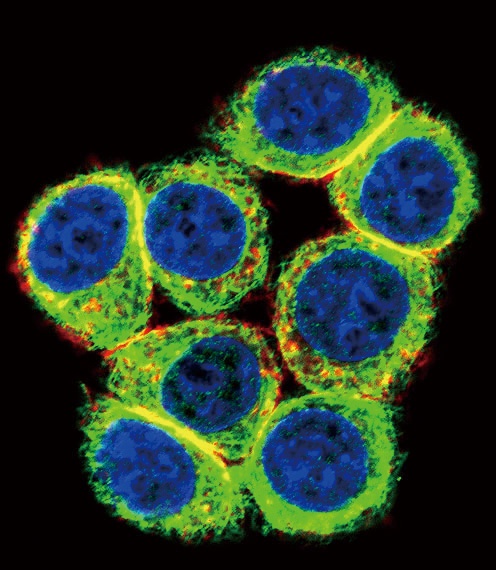 CBS Antibody