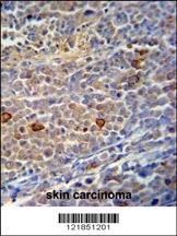 C9orf156 Antibody