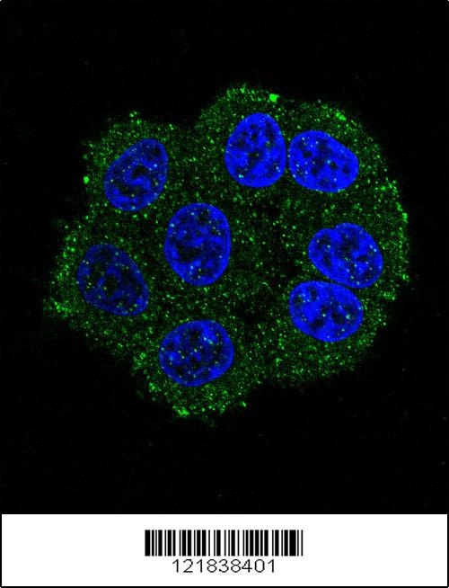 TMPRSS3 Antibody