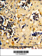 NDUFS4 Antibody