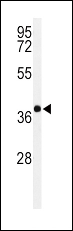 PAX6-T373 Antibody