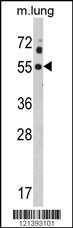 KCNJ2 Antibody