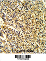 KCNJ2 Antibody