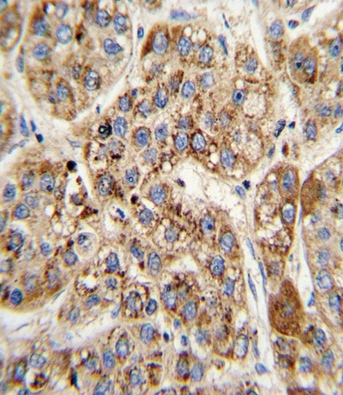 MCCC2 Antibody