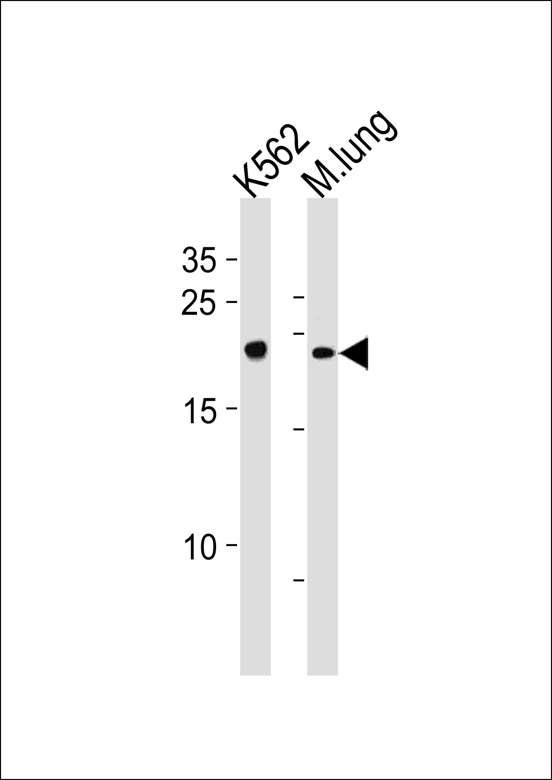 CBFB Antibody