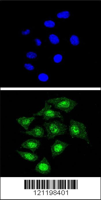 CBFB Antibody