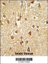 DLX2 Antibody