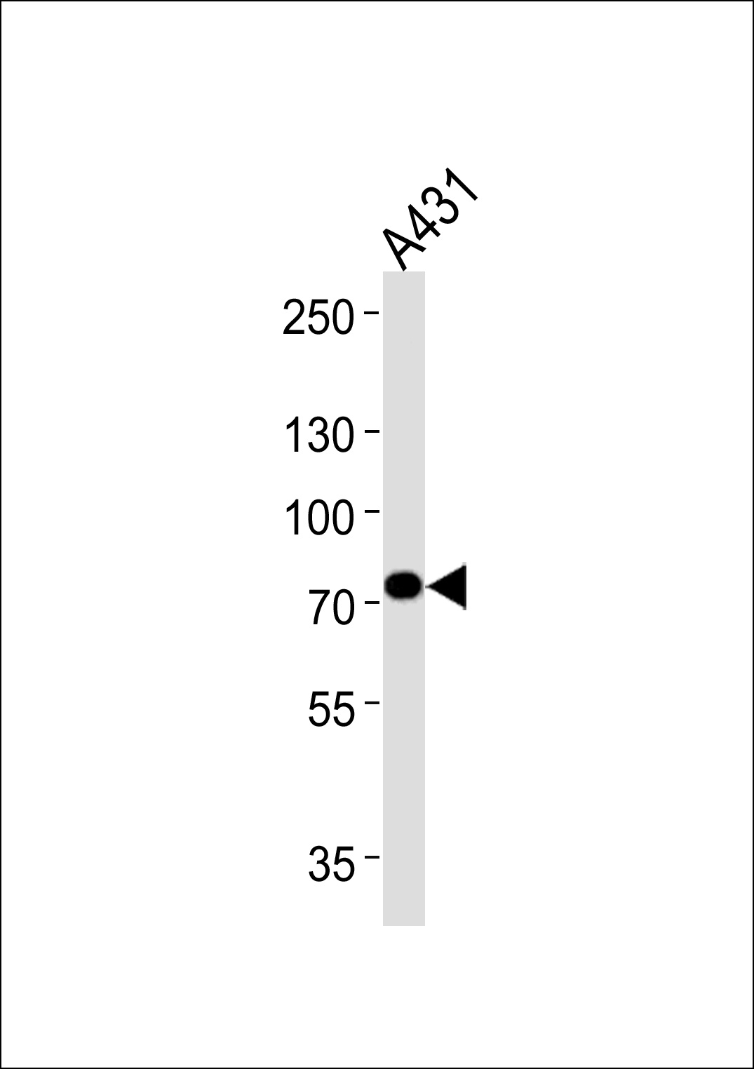 HADHA Antibody