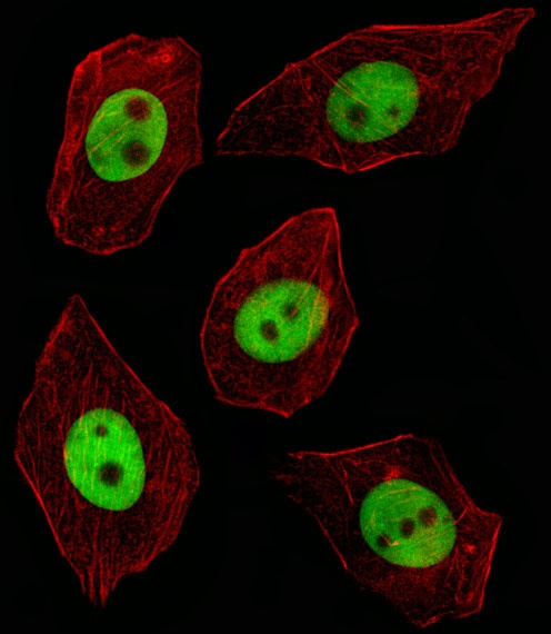 GTF2I Antibody