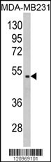 GALT Antibody