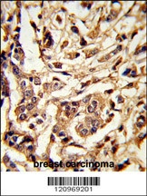 GALT Antibody