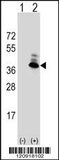 ASPA Antibody