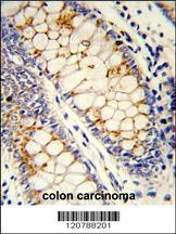 SFRS1 Antibody