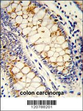 SRSF1 Antibody