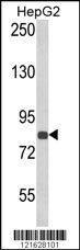 ECE1 Antibody