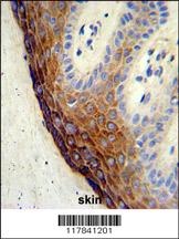 ECE-1 Antibody