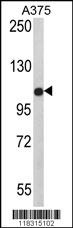 TECPR1 Antibody