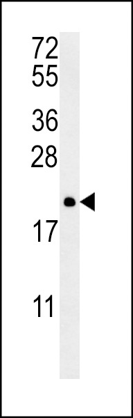 PTP4A2 Antibody