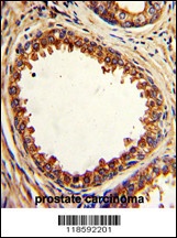 PTP4A2 Antibody