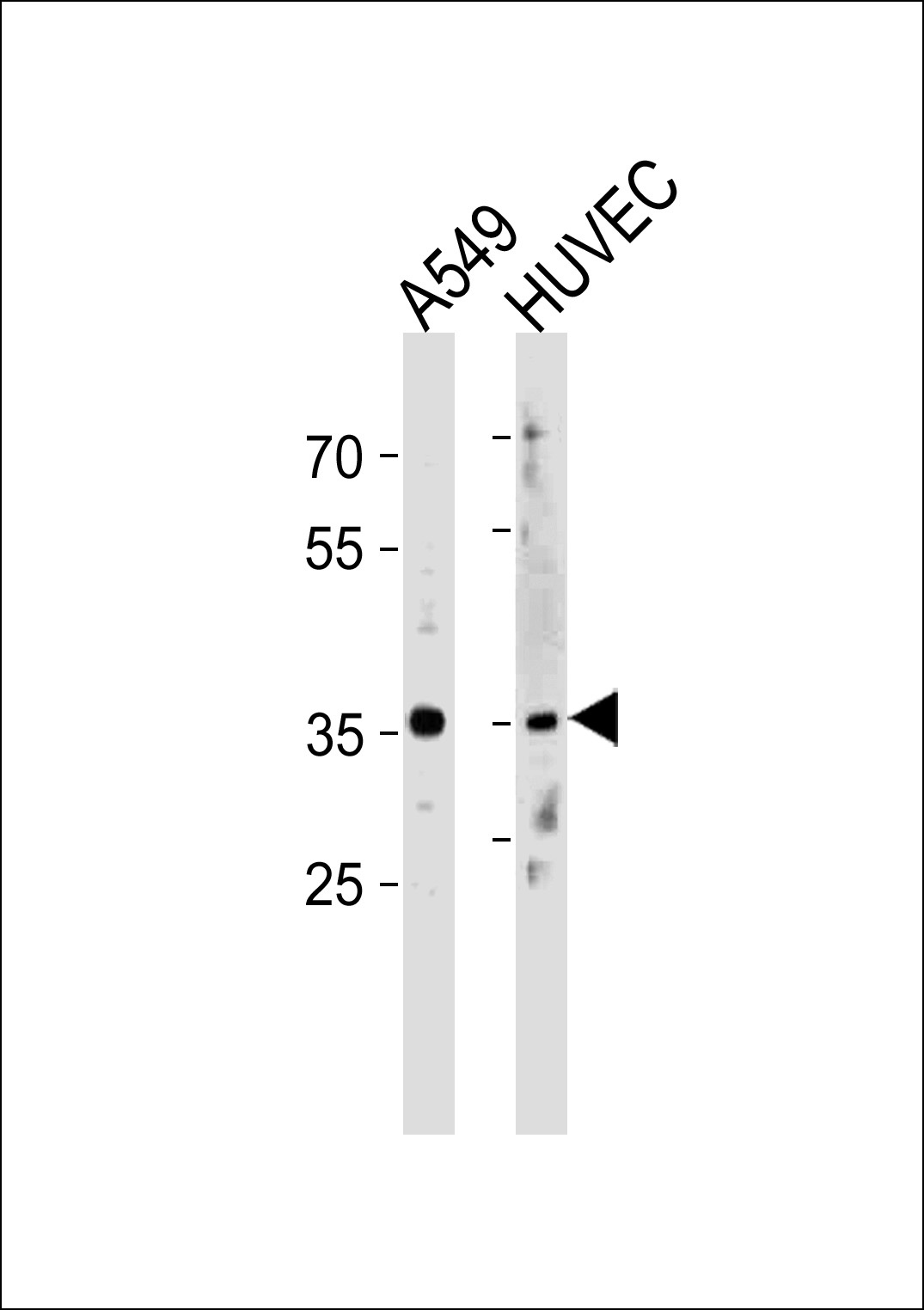 HOXB5 Antibody