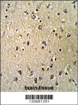 KPNB1 Antibody