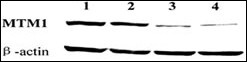 MTM1 Antibody