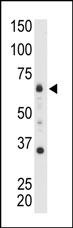 MTMR9 Antibody