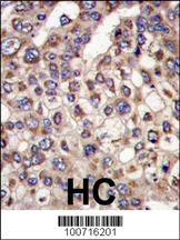 MTMR4 Antibody