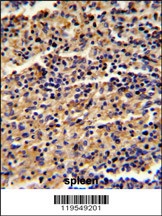 ALKBH8 Antibody