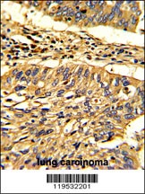 Hsp 60 Antibody