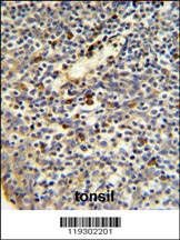 FKBP11 Antibody