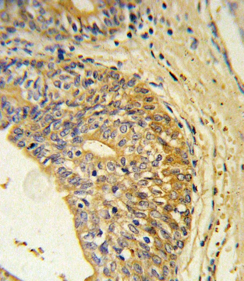 EDNRB Antibody