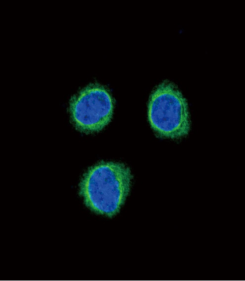 EDNRB Antibody