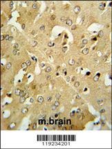 CRHR2 Antibody