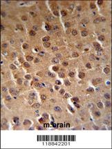 CDK14 Antibody