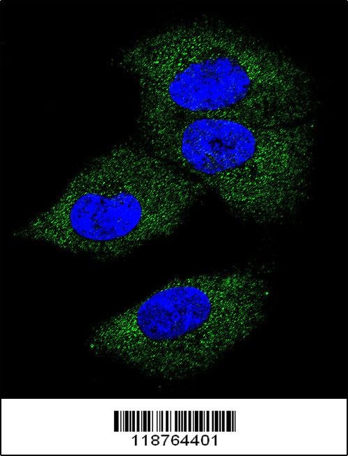 CSF1 Antibody