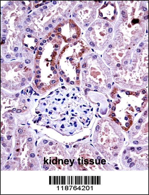 M-CSF Antibody