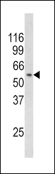 CHC1L Antibody