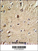 BGN Antibody