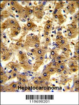 ADH1B Antibody